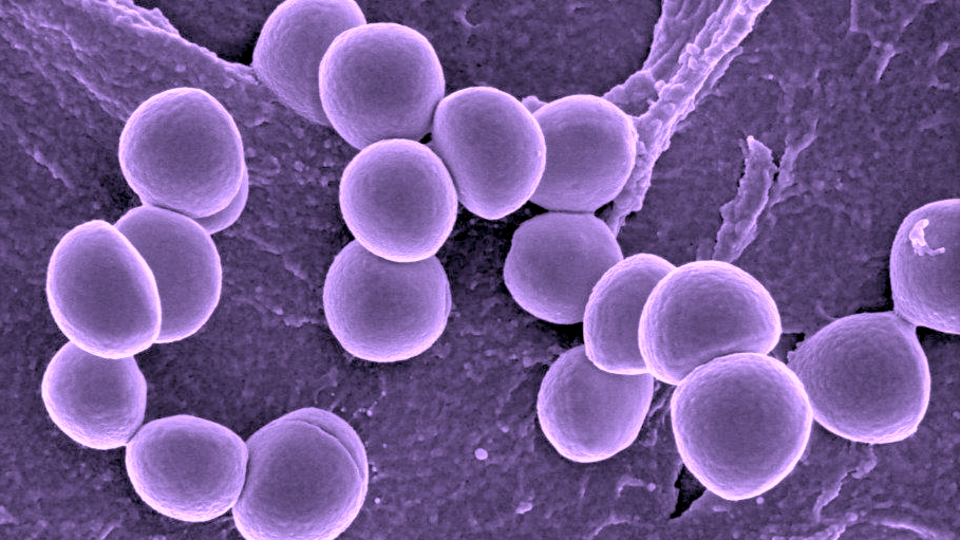 Research aims to prevent resistance to staph infection treatment